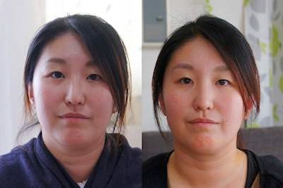 Before�AAfter�̈Ⴂ�ɒ���